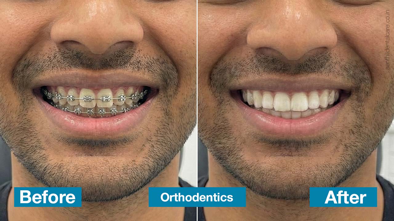 Ortho dentics.jpg