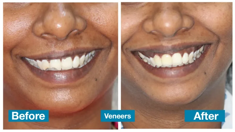Dental consultation at Senthil Dental Care in Chennai
