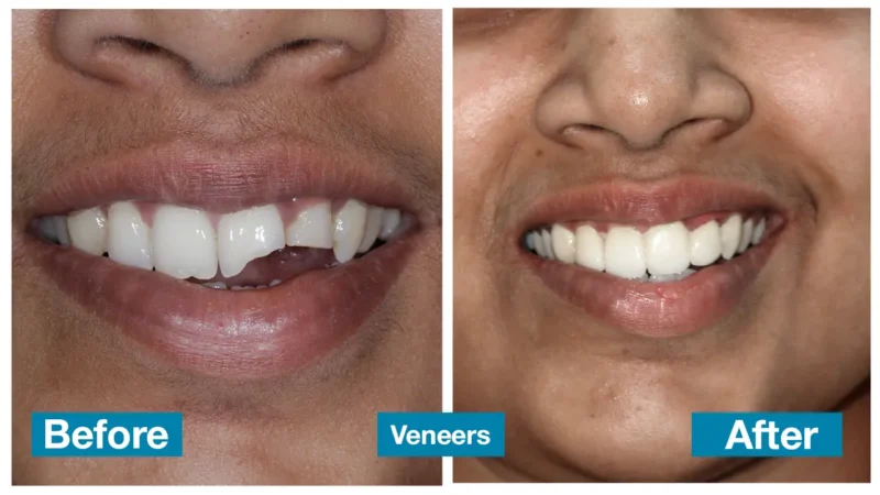 Professional oral health care in Chennai
