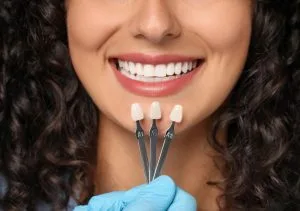 Complete Smile Makeover in Chennai