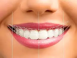 Cosmetic Dentist in Chennai
